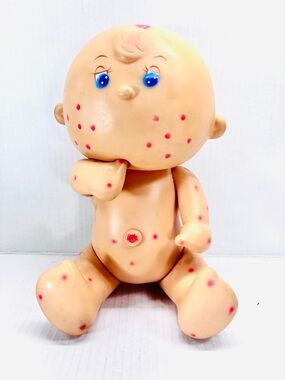 Tondo Morbillo Bambola Migliorati 1980’s Doll Only